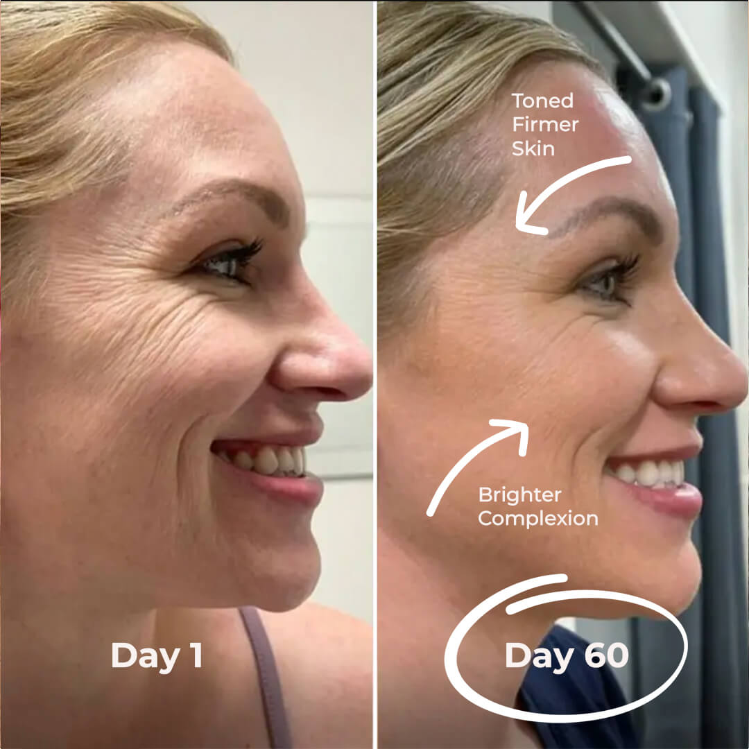 5MinSkin MicroSculpt + Hyaluronzuur Serum (30 Dagen Voorraad)