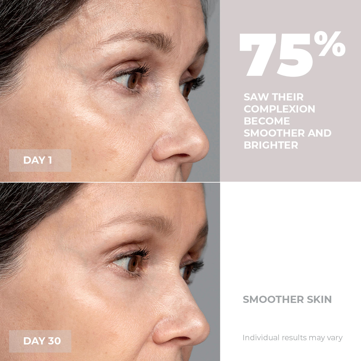 5MinSkin MicroSculpt + Hyaluronzuur Serum (30 Dagen Voorraad)